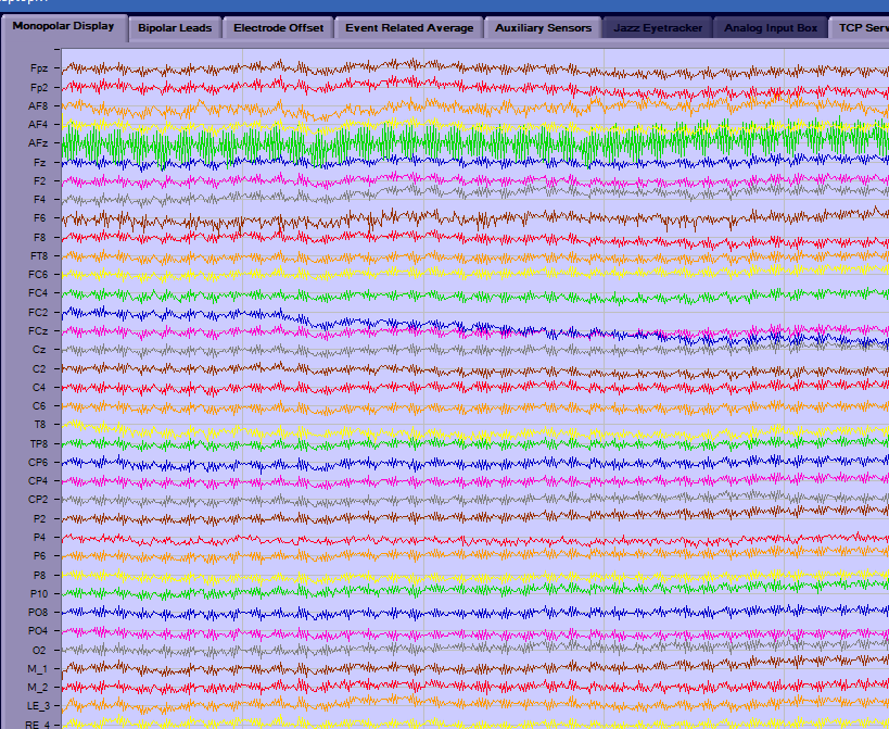 EEG_Noise_8.8.23.PNG