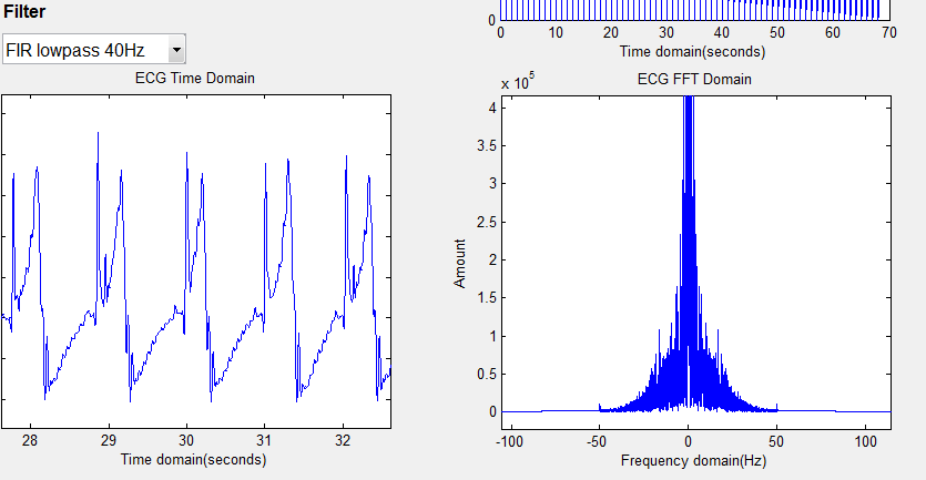 ecg_filtered.PNG