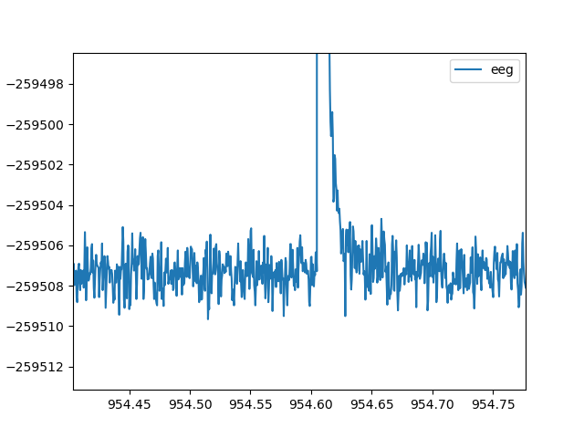 EEG_signal_zoom.png